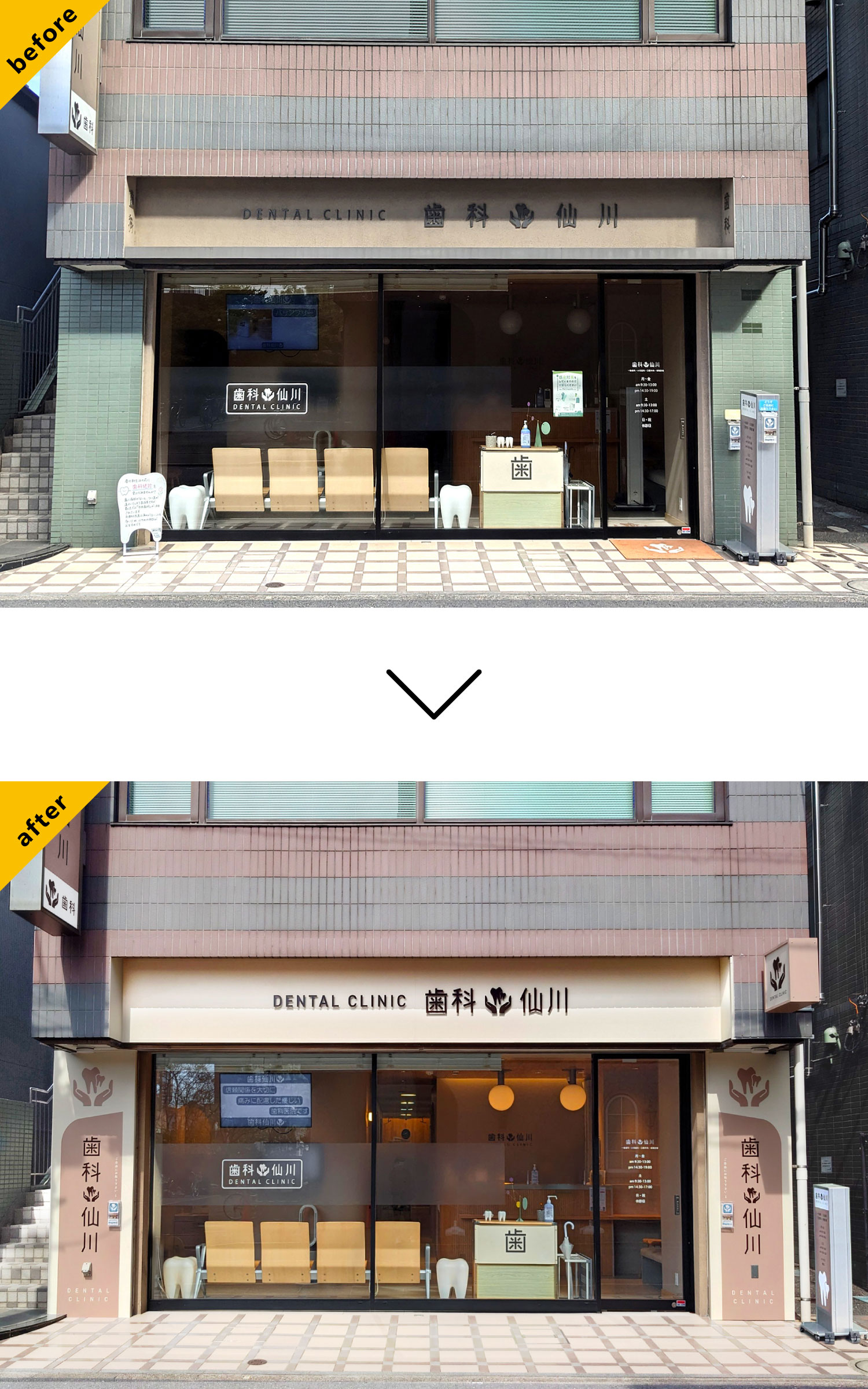 歯医者-おしゃれな看板-before-after