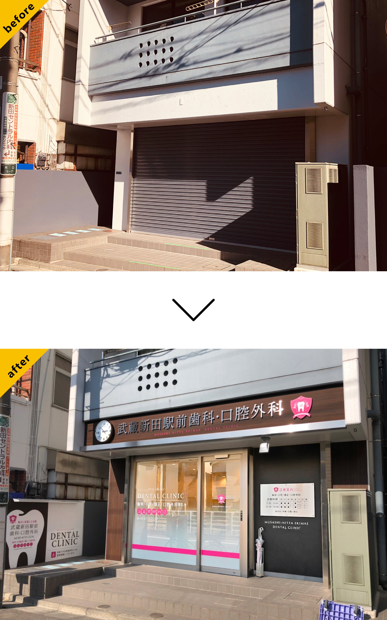 歯医者-おしゃれな看板-before-after