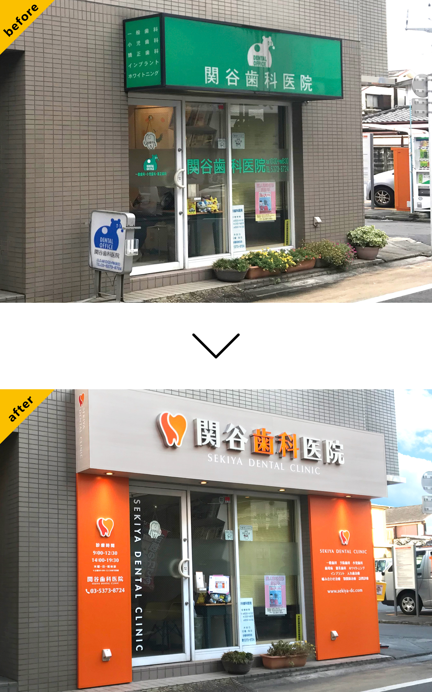 歯医者-おしゃれな看板-before-after