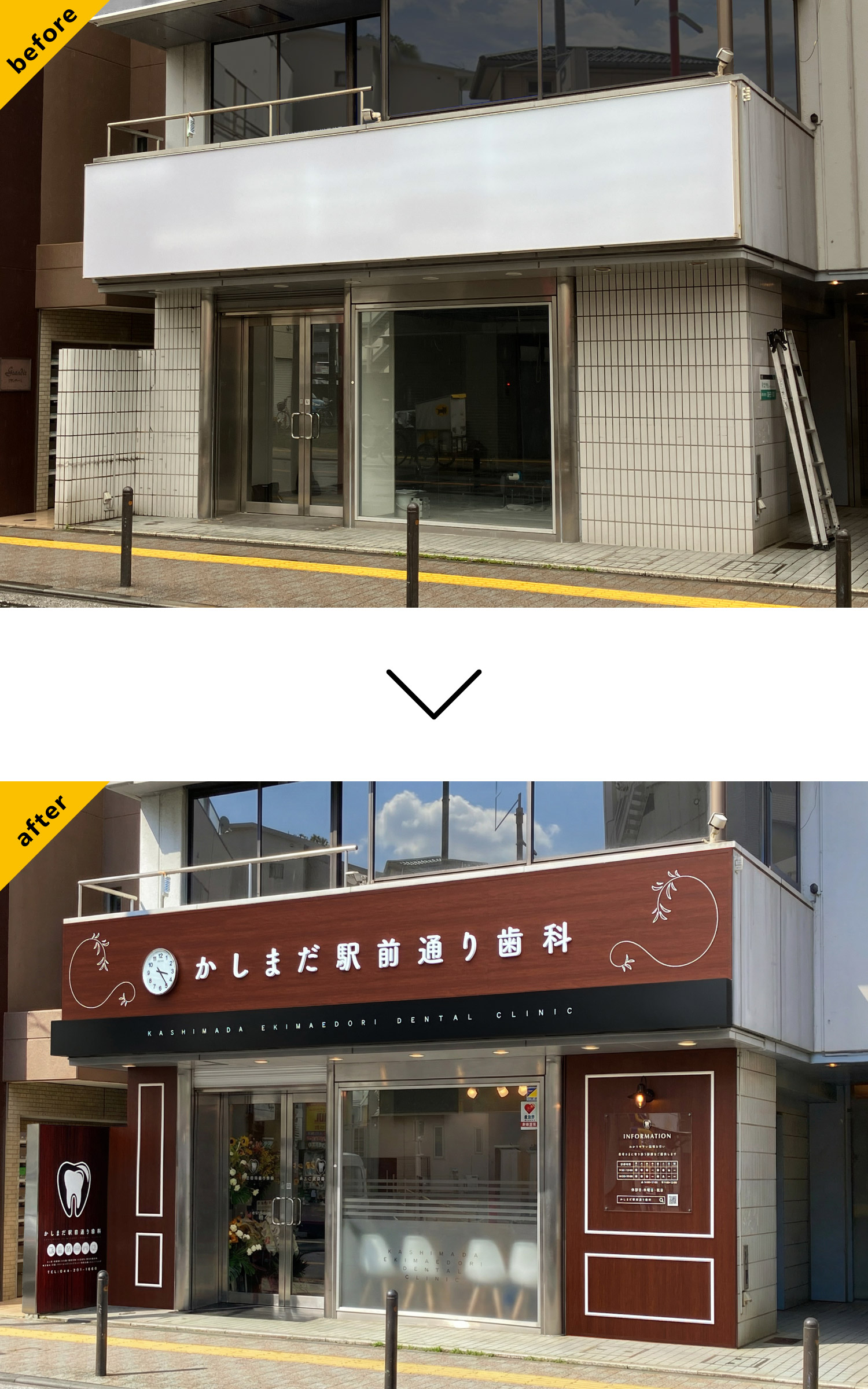 歯医者-おしゃれな看板-before-after