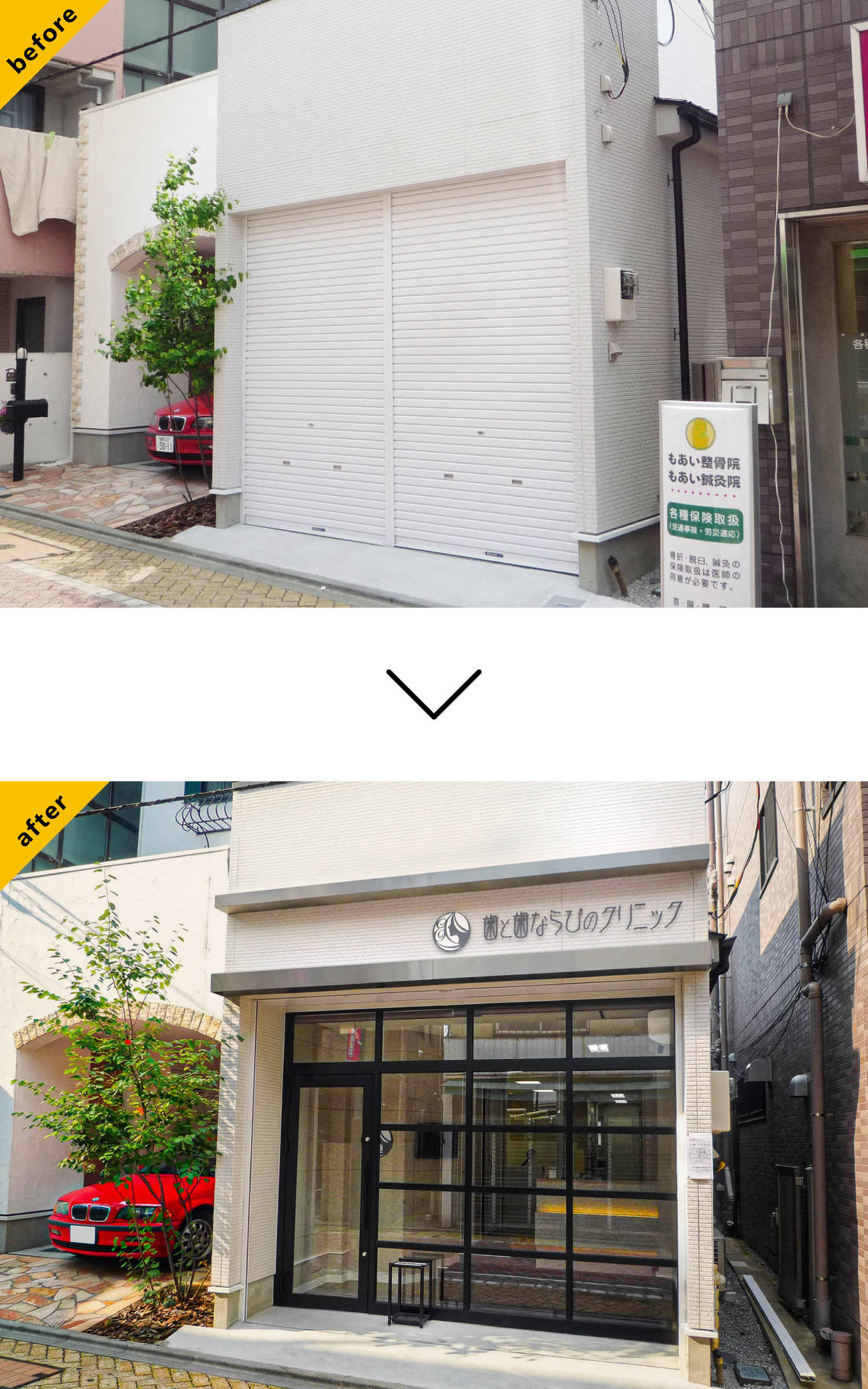 歯医者-おしゃれな看板-before-after