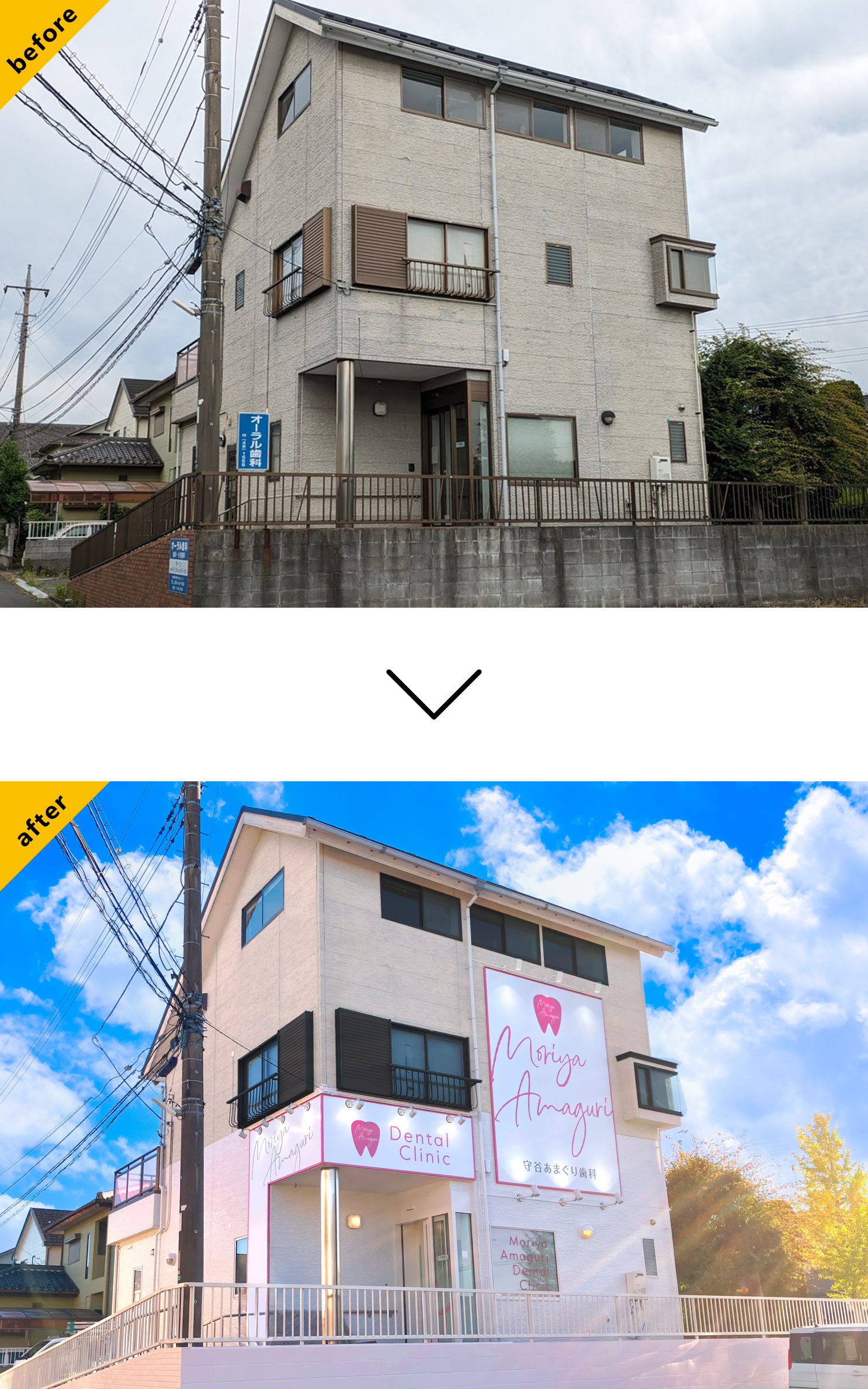 歯医者のおしゃれな看板-before-after