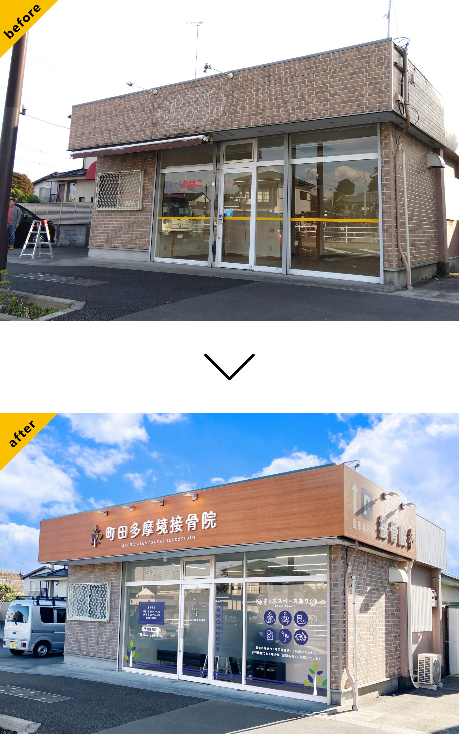 接骨院-おしゃれな看板-before-after